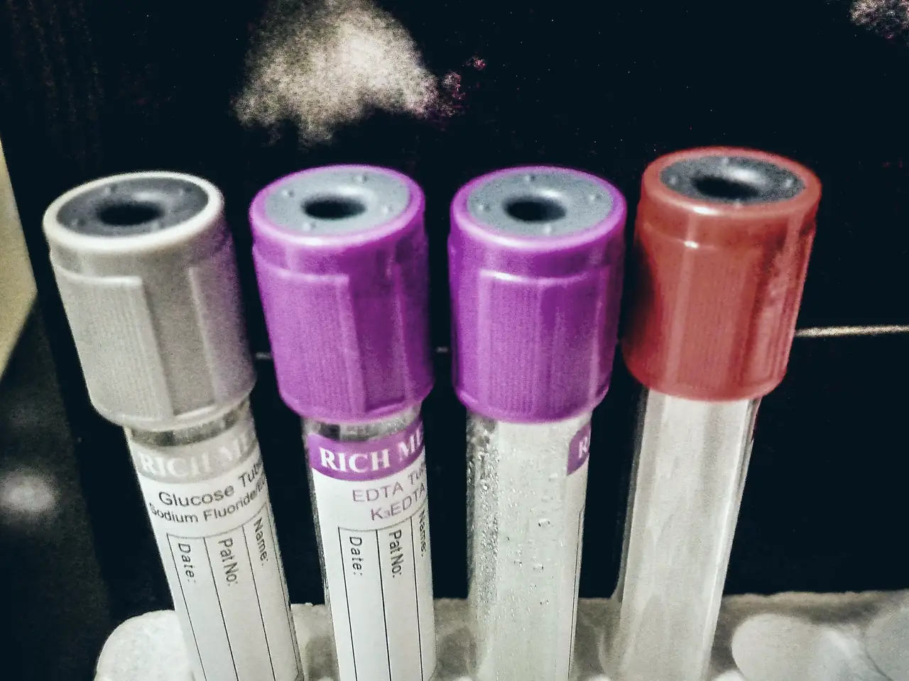 Blood collection tubes with grey, purple and red caps